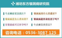 潍坊哪个医院可以治专业银屑病